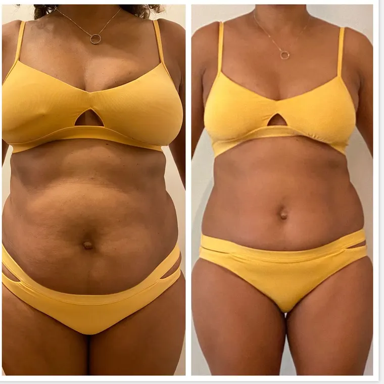 Antes e depois de aluna